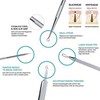 LUPO Comedones/Blackhead Remover Set – Stainless Steel Double Tool Kit – (Pack of 7)
