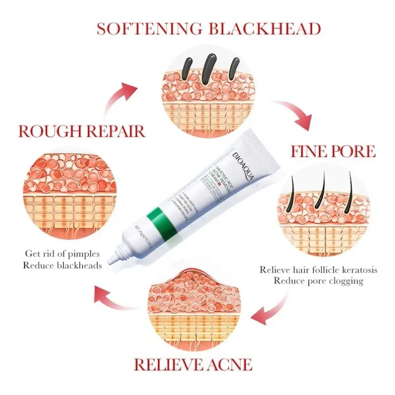 Crema Ácido Salicílico Bioaqua Control Acné Piel Grasa
