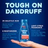 Selsun Blue Selsun Blue Botanical Anti-Dandruff Shampoo, 325mL, Botanical Scent,