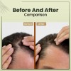 Aceite Para El Cabello Beepwell Batana Oil Para El Crecimien
