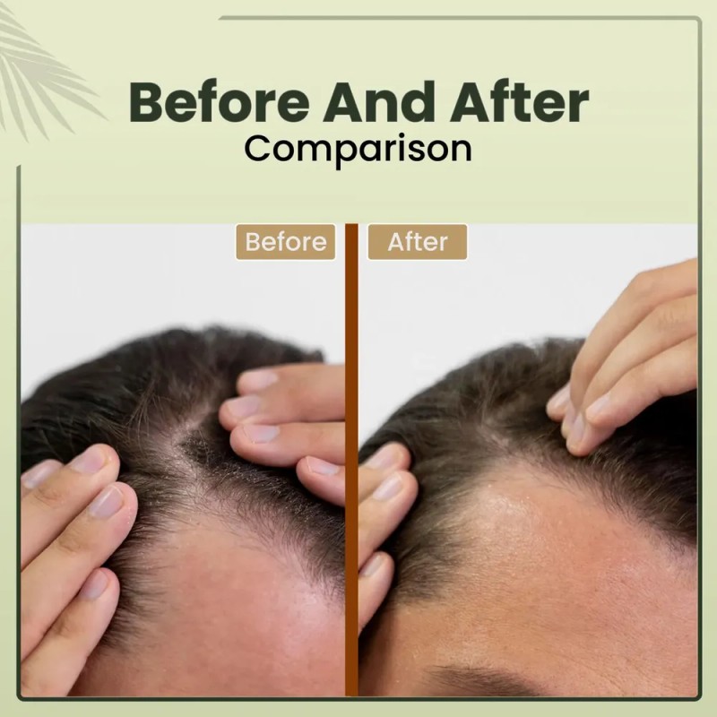 Aceite Para El Cabello Beepwell Batana Oil Para El Crecimien