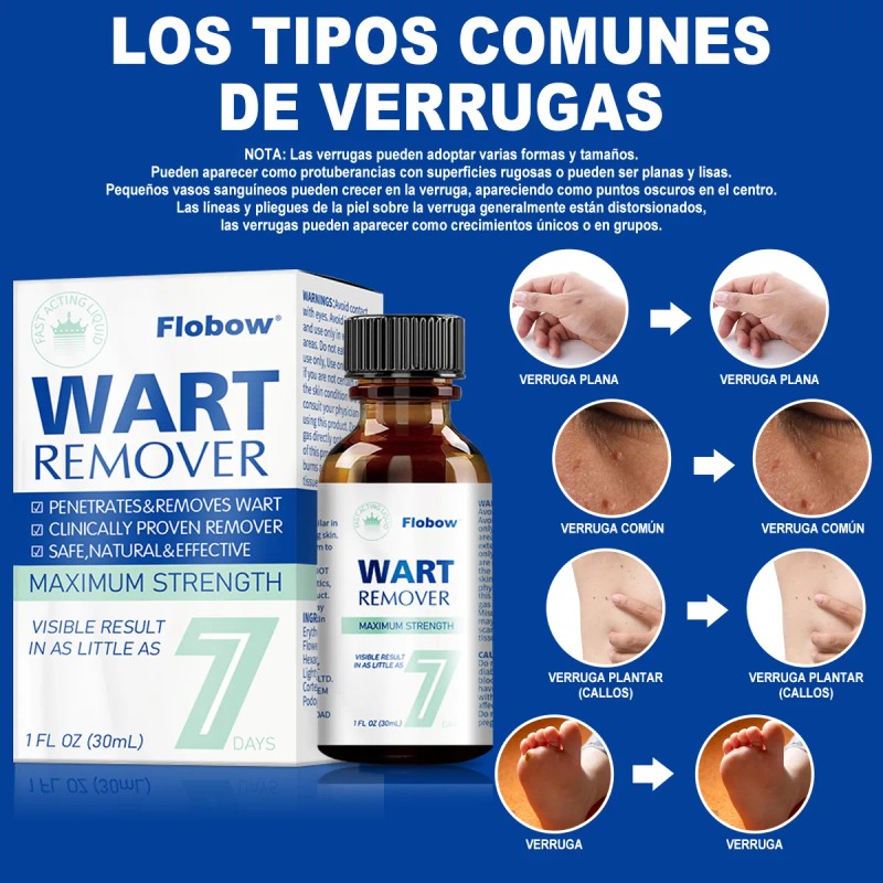 Líquido De Eliminación De Verrugas Plantar Y Comunes 1pc
