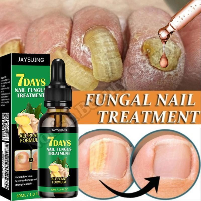 JAYSUING Ginger Nail Care Liquid, Nail Nutrients, Repairs Damaged and