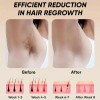 Professional 900,000 Flashes 5 Levels Laser Epilator Machine