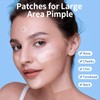 Large Pimple Patches for Face, Hydrocolloid Acne Patches, Variety Shapes