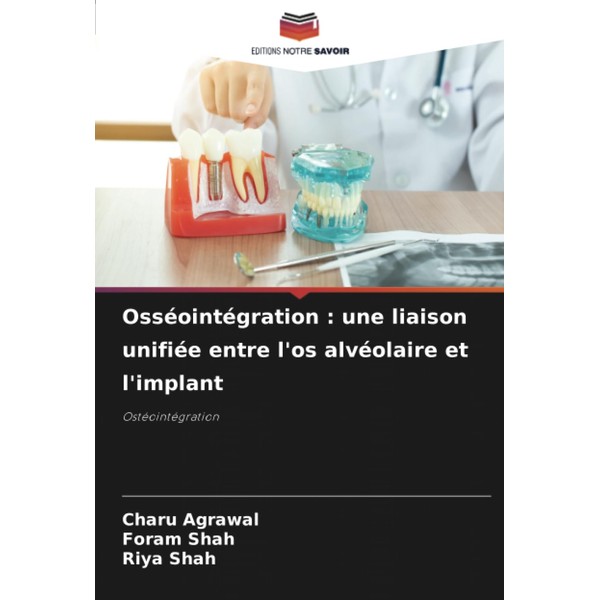 Osséointégration : une liaison unifiée entre l'os alvéolaire et l'implant:
