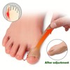 Toe Thumb Support Patch, 24pcs/set Toe Thumb Elastic Movement Sticker,