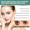 Jasmine Ointment for Dark Circles, Jasmine Ointment Eye Cream with