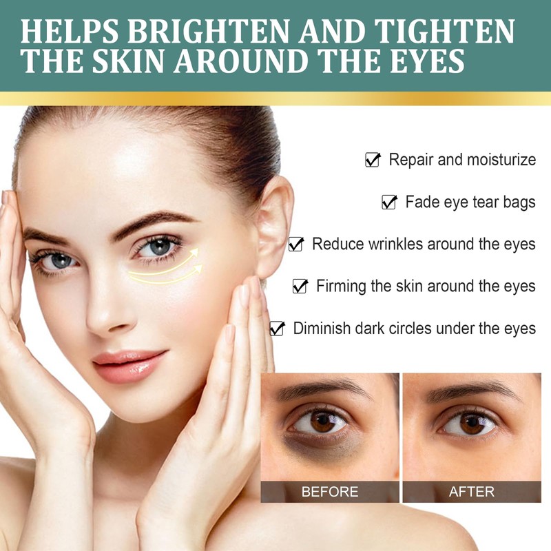 Jasmine Ointment for Dark Circles, Jasmine Ointment Eye Cream with