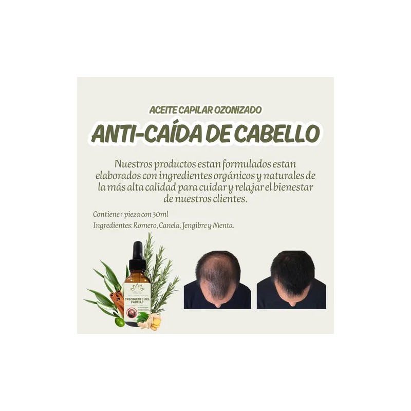 Aceite Capilar Ozonizado Romero Anti-caida De Cabello 30ml