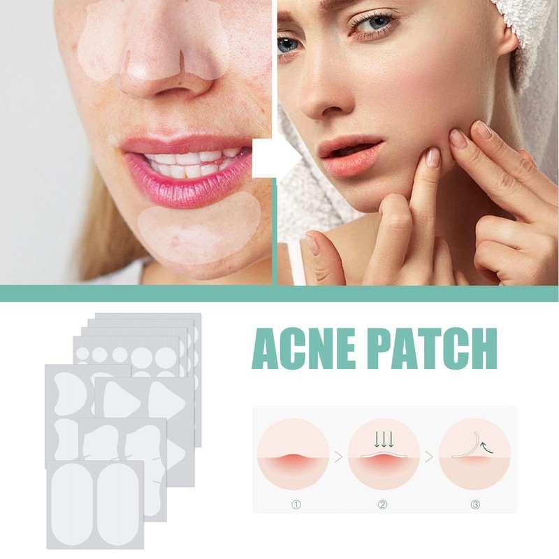 396Pcs Blemish Patches Facial Pimple Zit Spot Stickers Mild Non