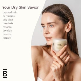 Blossom Essentials Crema de miel, reparación de hidratación para piel seca y con picazón, alivio de eccema y psoriasis para pieles sensibles, miel de manuka orgánica, 4 onzas (anteriormente
