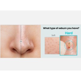 ilso 2x ILSO Super Melting Sebum Softener 150ml K-Beauty Pore Blackhead Care