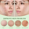 Mascarilla Limpiadora En Barra 2 Pc Té Verde