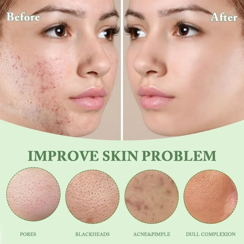 Mascarilla Limpiadora En Barra 2 Pc Té Verde