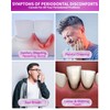 CAREDO Gum Disease Toothpaste, Gum Disease Treatment for Adults, Gum