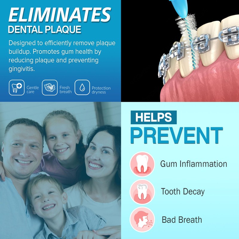 Paro Swiss FlexiGrip, X-Fine, Blue, Cylindrical, 3 Mm, 4 Pcs.