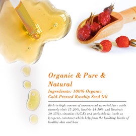 MMPANG Rosehip Seed Oil for Face (2 oz/60 ml) USDA Certified Organic 100% Pure Natural Cold Pressed Unrefined Rosehip Oil for Skin Anti-Aging, Scar, Hair Moisturizer, Gua Sha Massage, Nails