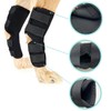 ZEACCT 1 Pair Dog Leg Braces, Front and Rear Knee