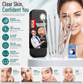 Herramientas de eliminación de puntos negros, kit de herramientas para reventar espinillas, paquete de 6 extractores de comedones profesionales para eliminar el acné para manchas, estallido de puntos blancos, eliminación de granos para la nariz y la cara,