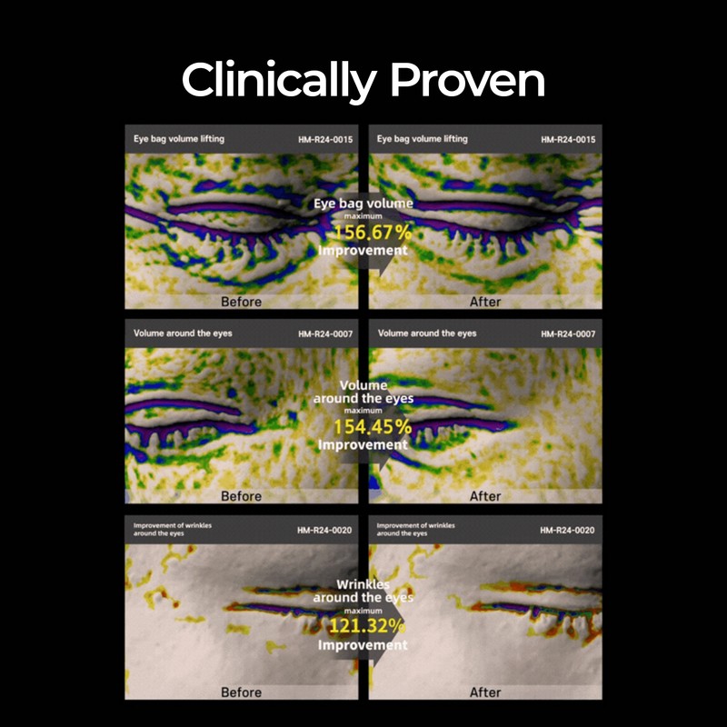 Dr.Melaxin [Dr.Melaxin]Eyephalt Eyebag Cream 10ml