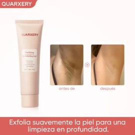 Gel Exfoliante Blanqueador Quarxery Para Eliminar Puntos Neg