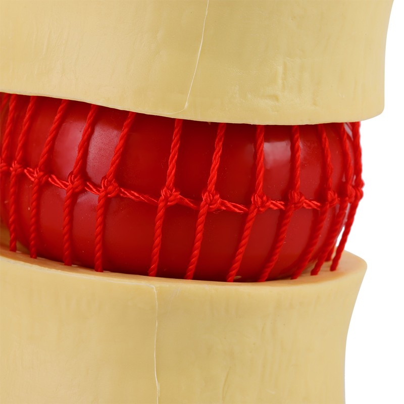 1:1.5 Anatomical Medical Human Spine Lumbar Disc Herniation Demonstration Model