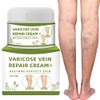 Crema de venas varicosas, crema reparadora de araas vasculares, tratamiento