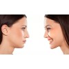 3D Rhinoplasty Respingadores Nasales 7 Pzs Corrector Levanta Nariz Estiliza