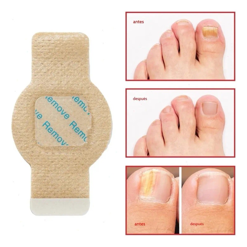 Lc Parches Para Uñas Fúngicos 21pcs/caja De Parches Para
