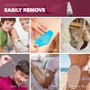 Skinister Medical Adhesive Remover for Skin | Wig, Ostomy, Tape,
