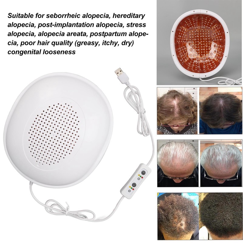 Laser Hair Growth Device 272 Lamp Chips 3 Gears USB