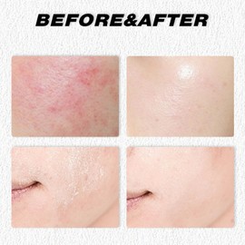 Grass-Fed Tallow Balm for Face & Body - Deeply Nourishing Moisturizer with Beef Tallow, Ideal for Dry Skin Care