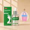 Kerazome Consists of 1 Kerazom Cure Solution 30ml + mesh