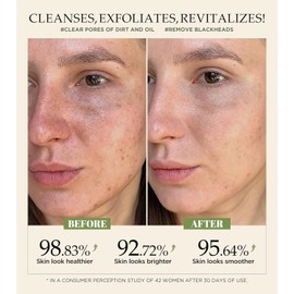 Activating Exfoliating Face Scrub with Vitamin C and Turmeric - A gentle wash for blackheads, pores, dirt and dark spots Daily balancing for all skin types 4.23 Fl Oz Turmeric VC / 비타민 C와 강황이 함유된 각질 제거 페이스 스크럽 활성화 - 블랙헤드 모공 먼지 및 다크 스팟을 위한 순한 워시 모든 피부 타입을 데일리 밸런싱 4.23 Fl Oz Turmeric VC