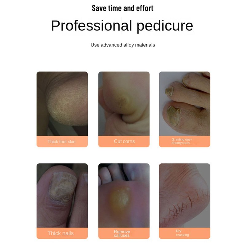 Electric Feet Callus Grinder Remove Dead Skin Rechargeable Foot File