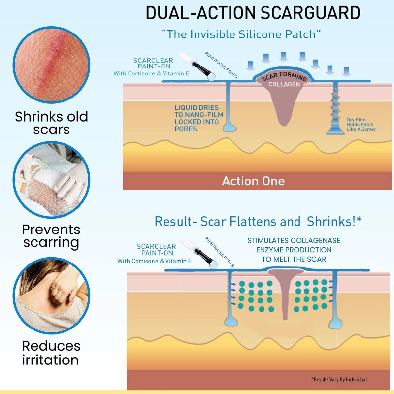 Scarguard - Invisible Brush-On Silicone Sheet with Vitamin E -