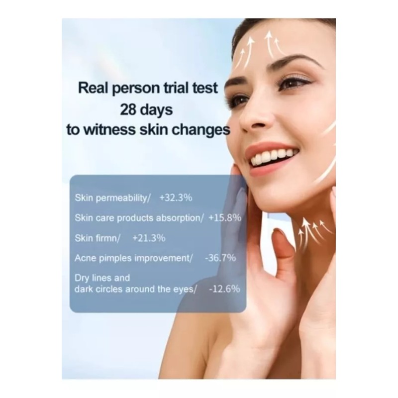 Mismon Radiofrecuencia Facial + Galvánica + Led Rejuvenece Arrugas