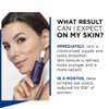 L'Oreal Paris Revitalift Laser Pure Retinol Serum, Anti-Wrinkle, Anti-Fine line,