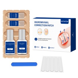 Ingrown Toenail Treatment, 10 packs Titanium Alloy Ingrown Toenail Corrector for all size foot, Ingrown Toenail Removal Kit for Curved Nail Repair, at Home Nail Kit Tools-Blue3