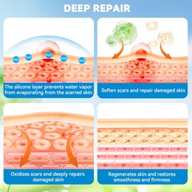 Silicone Scar Sheets Face Tape: Scar Tape for Surgical Scars - Medical Grade Wrinkles Patches -Reusable Strips Scar Removal Treatment C-Section Keloid Burn Tummy Acne Wounds Recovery (1.6”x 60”)