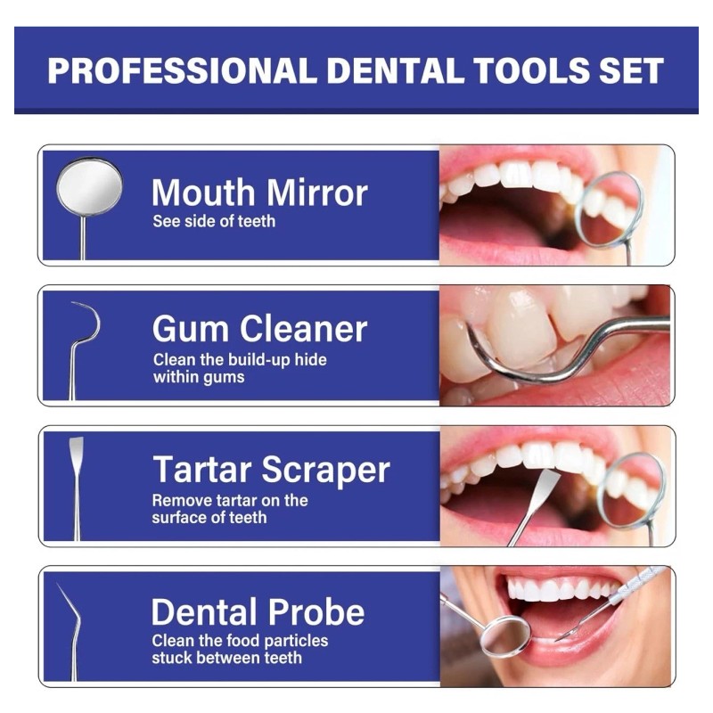 Copeaky Broken Teeth Repair Kit Shapeable Beads