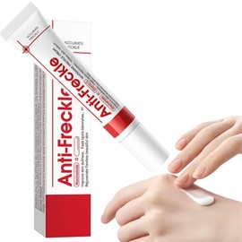 Freckle Cream Vitamin C Freckle Cream for Adults with O+ Technology, Fades Dark Spots & Sun Spots, Brightens Dull Skin, Spot for Women - Improve Skin Dullness, Fade S-pots Blemishes