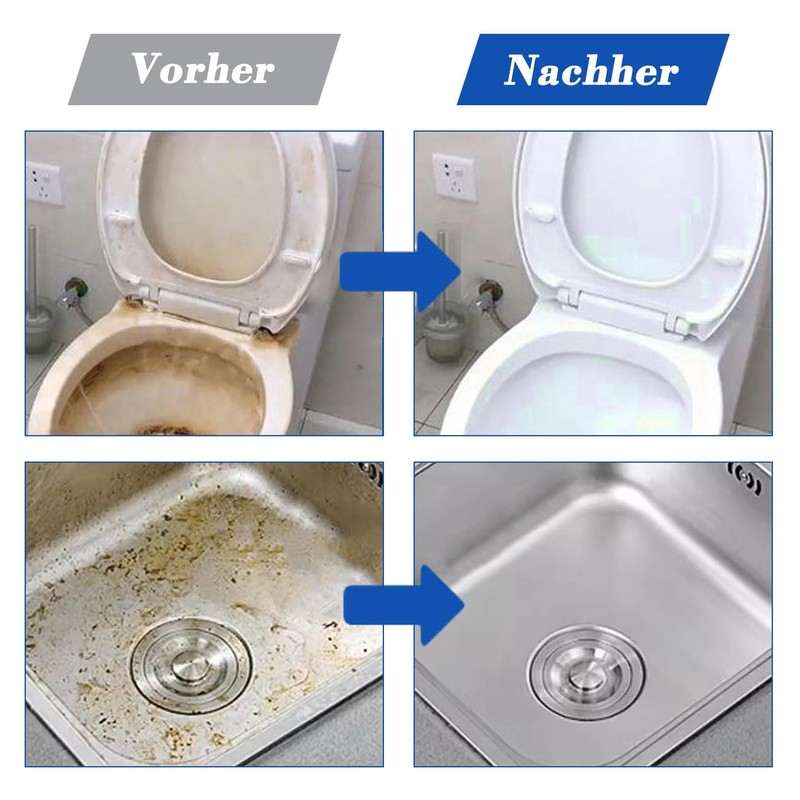 Auriselle 5 Stück Bimsstein WC Block Doppelaktion Fußpflege Bimsstein Hornhautentferner