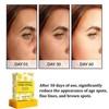 Turmeric & Lemon Kojic Acid Soap Bar for Fine Lines