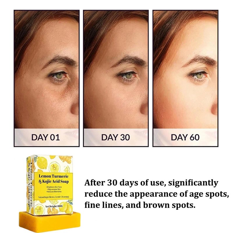 Turmeric & Lemon Kojic Acid Soap Bar for Fine Lines