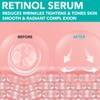 Retinol Serum Face with Retinol, Hyaluronic Acid and Vitamin E