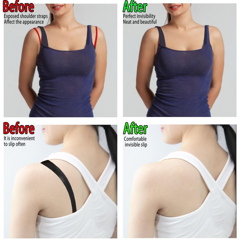 Prasacco 6 Pcs Bra Strap Holders for Slipping, Women's Elastic