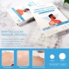 144 Parche Adhesivos Para Imperfecciones Piel Acné Verrugas