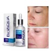 Mafab Bioaqua Serum Pure Skin Retira Acne Espinillas Regenera Full